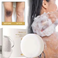 Body Whitening Soap Underarm Knee Bleaching Soap Chicken Skin Removal Dark Spot Removal Dead Skin Moisturize Brighten Body Care