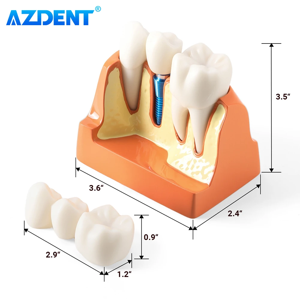 AZDENT 치과 4 배 치아 모델 임플란트 분석 크라운 브리지 데모 이동식 치과 연구 훈련 교육 모델