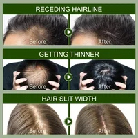 Sérum de croissance des cheveux 7 jours, Capsule essentielle de repousse rapide, Anti-perte de cheveux, réparation de la calvitie, traitement du cuir chevelu endommagé pour femmes et hommes 4