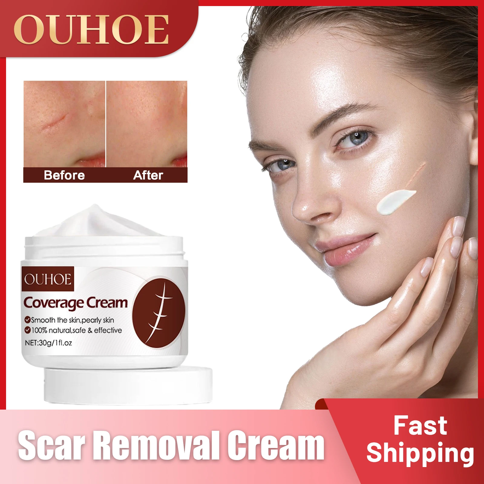 

Scar Removal Cream Treat Surgery Scars Stretch Marks Coverage Acne Pox Prints Burn Repair Smoothing Whitening Skin Care Products
