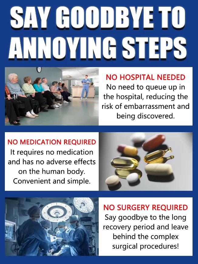 XJG03 홈 제작용 제거 부품, 초고성능 사마귀는 점차적으로 7일 안에 떨어져 갈라질 것입니다.