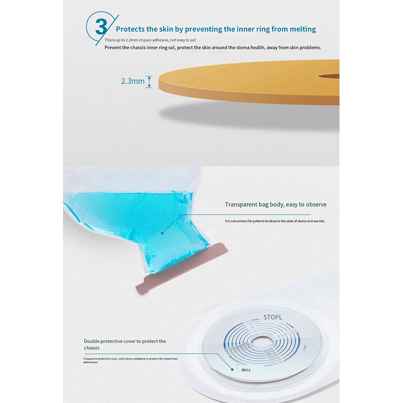 Comvita One-piece Stoma Bag Disposable Stoma Bag Fecal Anus Rectum Ostomy Pouch Clip Closure Supplies Health Care 22771