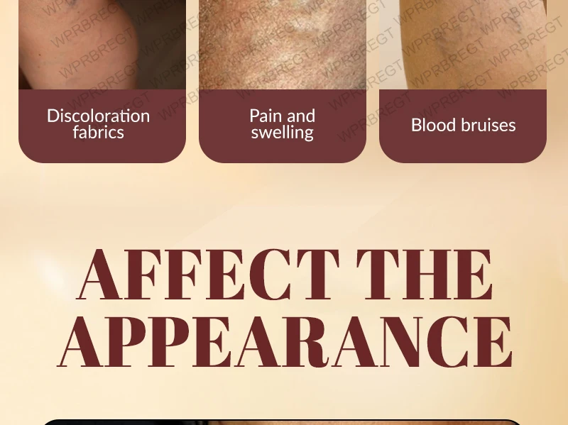 Pulse Massage Patch Eliminates Varicose Veins And Effectively Improves Blood Circulation_voghion.com