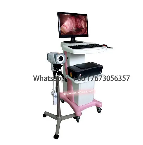 

Цифровой электронный видеоролик для обнаружения влагалища Colposcopy DVC5003