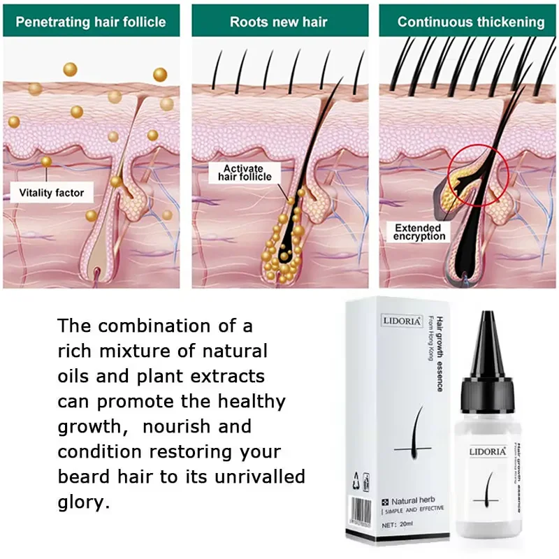 Premium Hair Growth Oil Hair Repair Baldness Repair Hereditary Postpartum Seborrheic