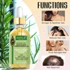 Braid Cleansing Care Set Dreadlock Shampoo for All Hair Types Braiding Mousse Rosemary Oil for Moisturizing Hair Scalp Soothing 5