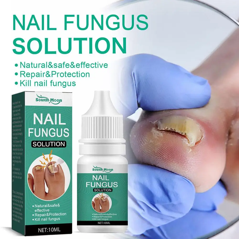 

Сильное Лечение грибка ногтей, средство для ухода за ногами, эссенция для удаления грибковой инфекции, противогрибковая инфекция L9t1