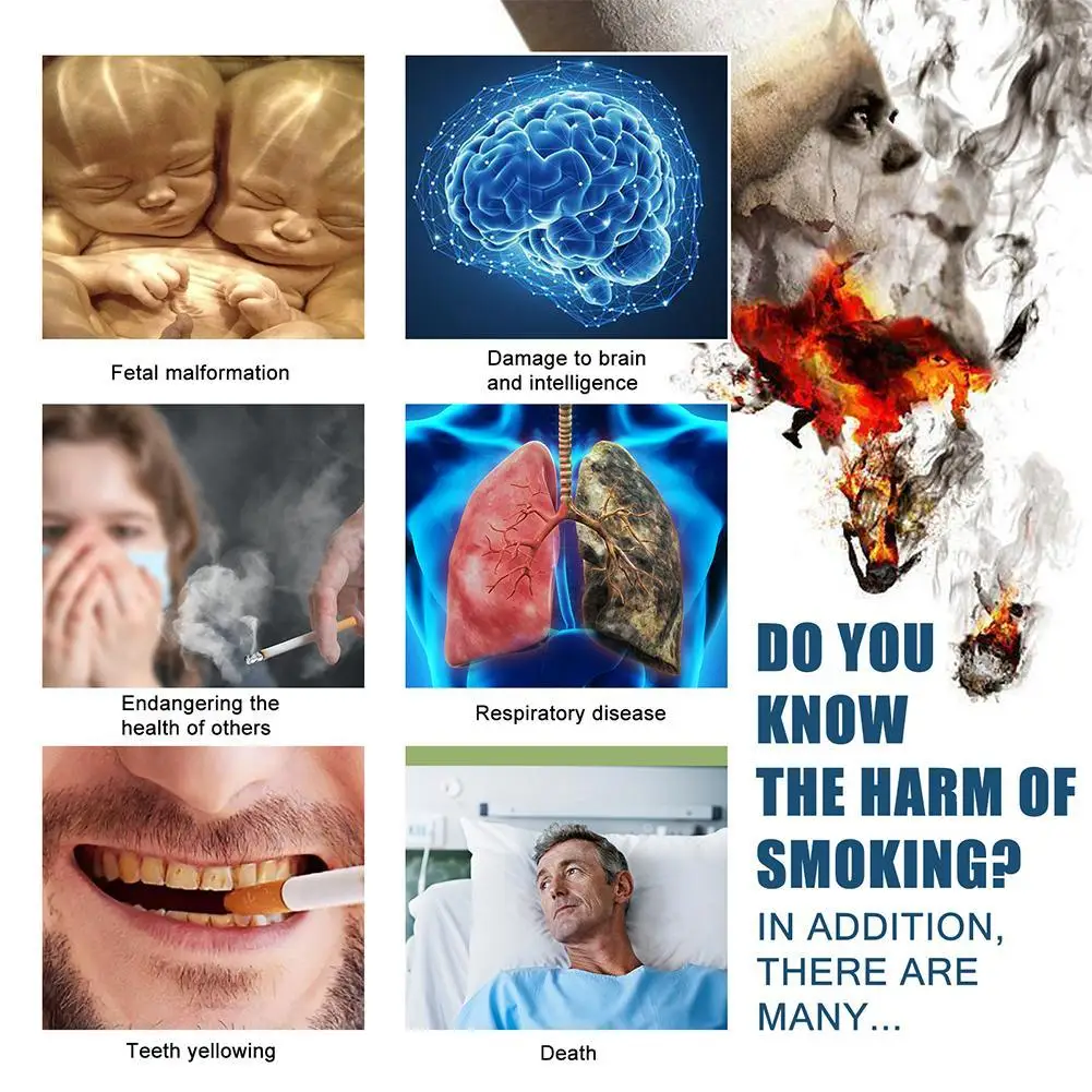 Stop Smoking Patches Anti-smoke Patch Smoker Health Therapy Natural Ingredient 21pcs/box Easy And Effective Stop Smoking Aid