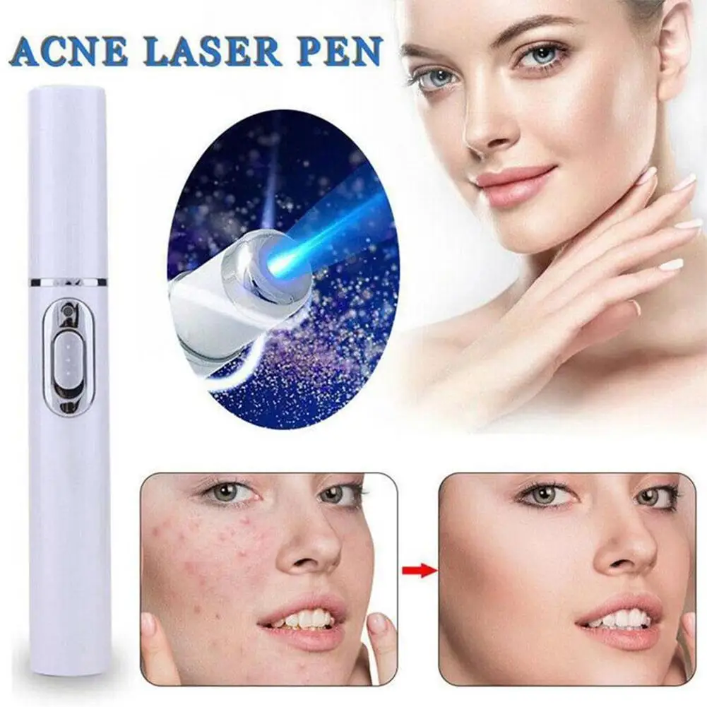 For Acne Laser Pen Portable Wrinkle Removal Machine Soft Scar Remover Device Blue Light Therapy Pen Massage