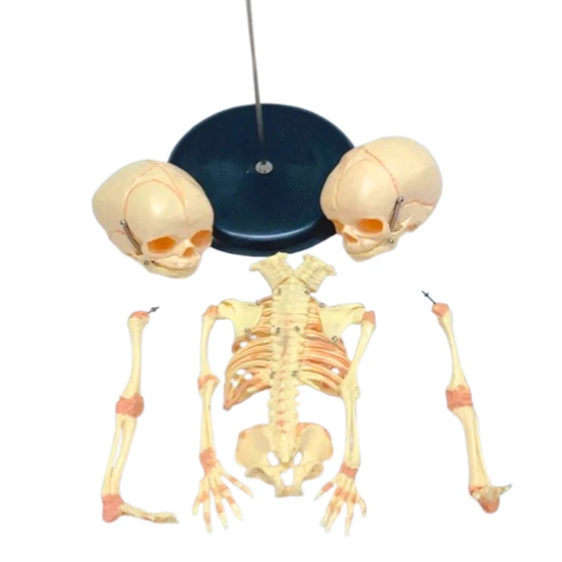Human Double Head Baby Skull Model Skeleton Anatomy Medical Science Display Study Teaching Model
