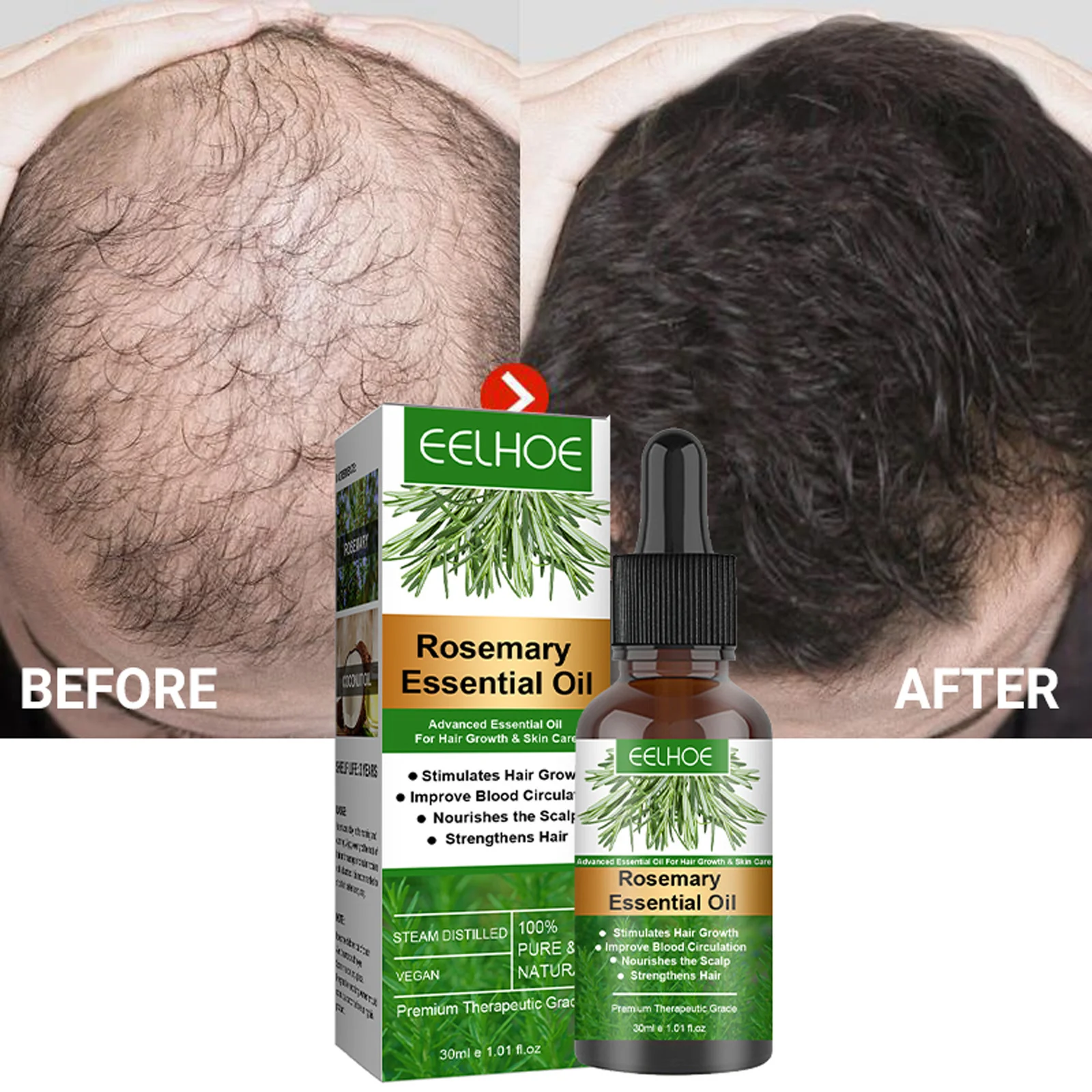 Rosemary Hair Growth Products Anti Hair Loss Essential Oil Fast
