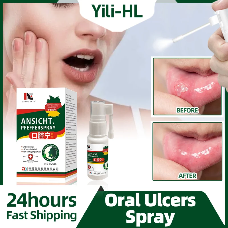 

Mouth Ulcer Treatment Medicine Oral Ulcers Relief Canker Sores Antibaterial Clean Freshner Spray German Secret Recipe