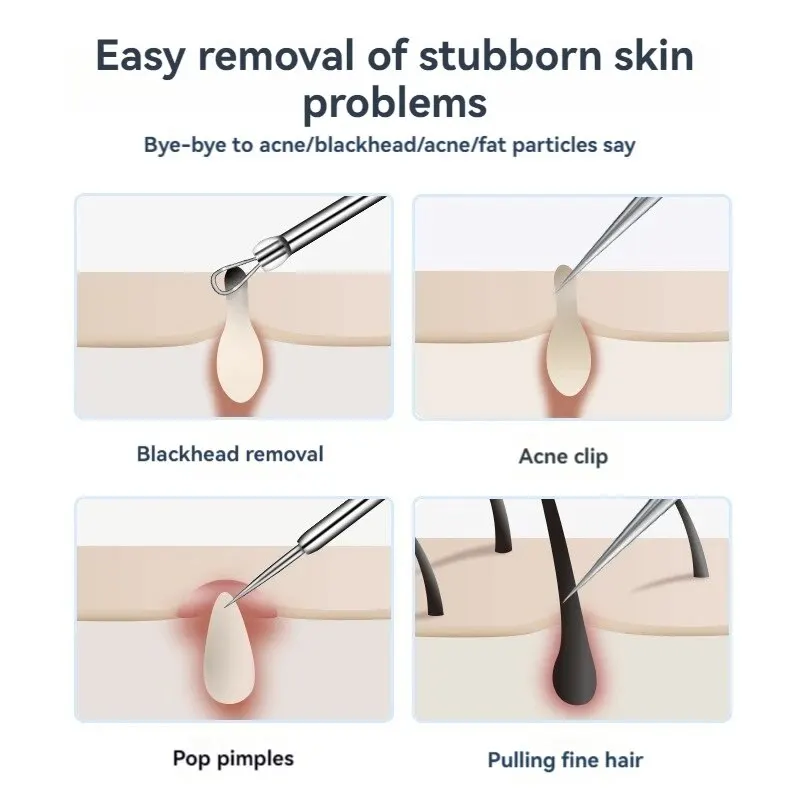 7pcs Stainless Steel Acne Clip Tools for Beauty Salon Acne Removal