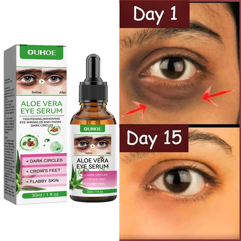 Verblasst Anti-Falten-Creme, feine Linien, Anti-Augenringe, Serum, entfernt Taschen, Schwellungen, Anti-Aging-Festigkeit, Augenpflege – Alterung_voghion.com
