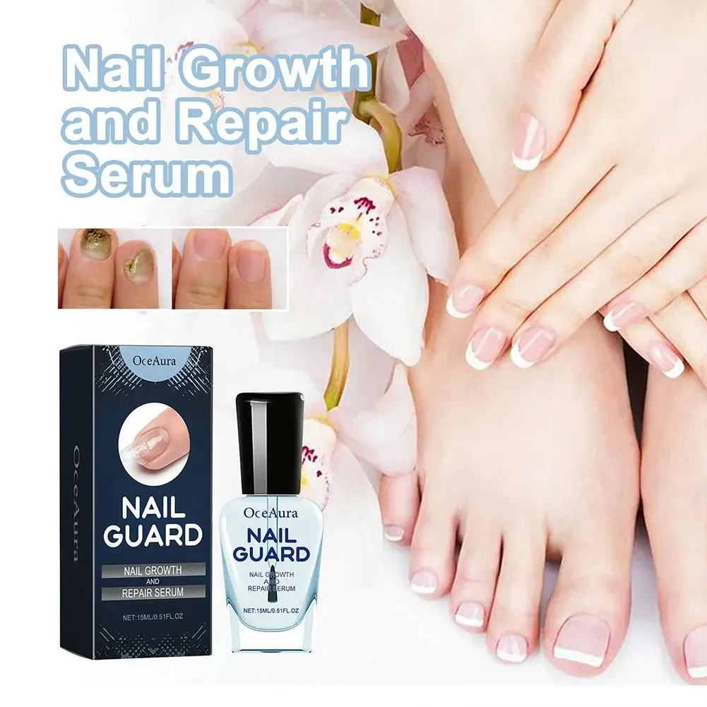 

15ml Hand Foot Nail fungal Treatment Solution To Remove Onychomycosis Repair Healthy Nail Care Liquid Liquid Repair Care C4U1