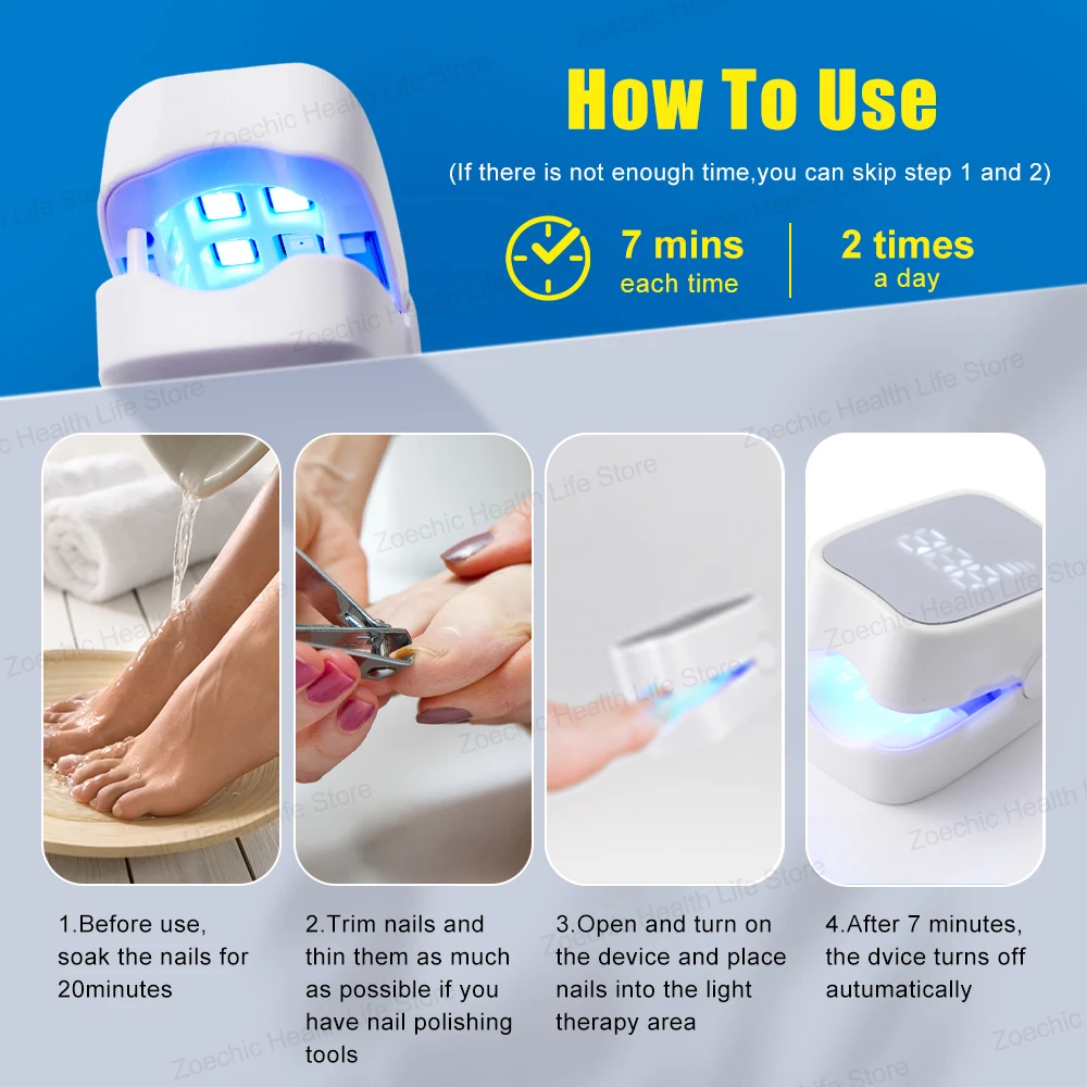 Time Display Fungal Nail Treatment Laser Device Foot Nail Repair Patch Toenail Laser Therapy Machine Ingrown Toenails Foot Care