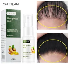 

Ginger Hair Growth Spray Essence For Anti Hair Loss Essential Oil Fast Grow Anti Hair Loss Treatment Hair Thinning Dry Hair Care