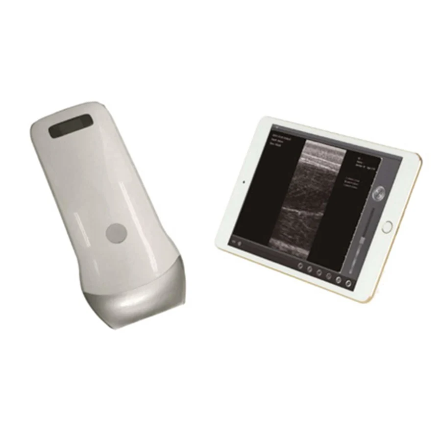 

UProbe-2B Wireless Back Fat and Lion Checker Animal Ultrasound Probe