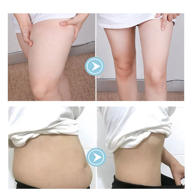 Produtos essenciais perder óleos fino perna cintura queimador de gordura queima anti celulite perda de peso óleo de emagrecimento_voghion.com