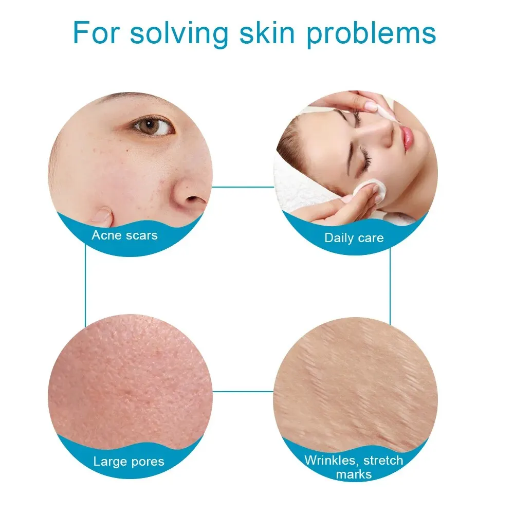 Revitalizing Micro Needle Derma Roller for Radiant, Youthful Skin