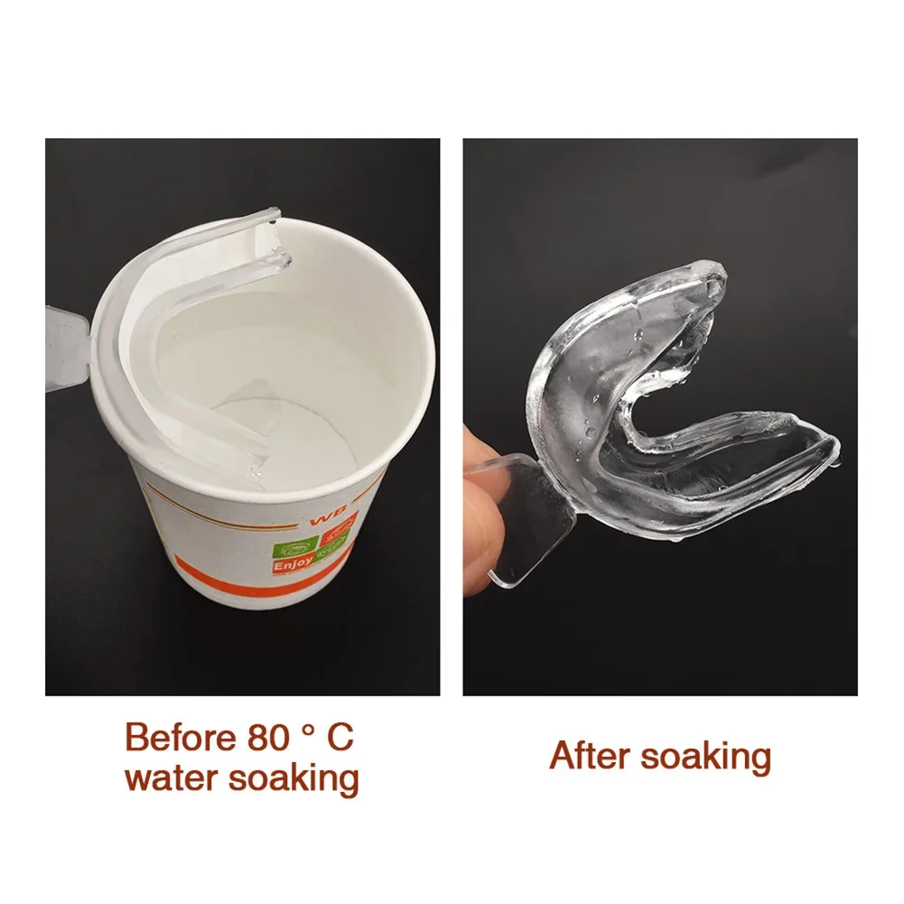 2/4pcs Soft Silicone Tooth Orthodontic Braces Set Mouth Guard Protector Dental Teeth Whitening Trays Retainers Oral Hygiene Care