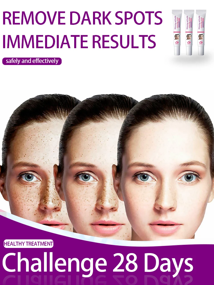 

Dark Spot Remover for Face