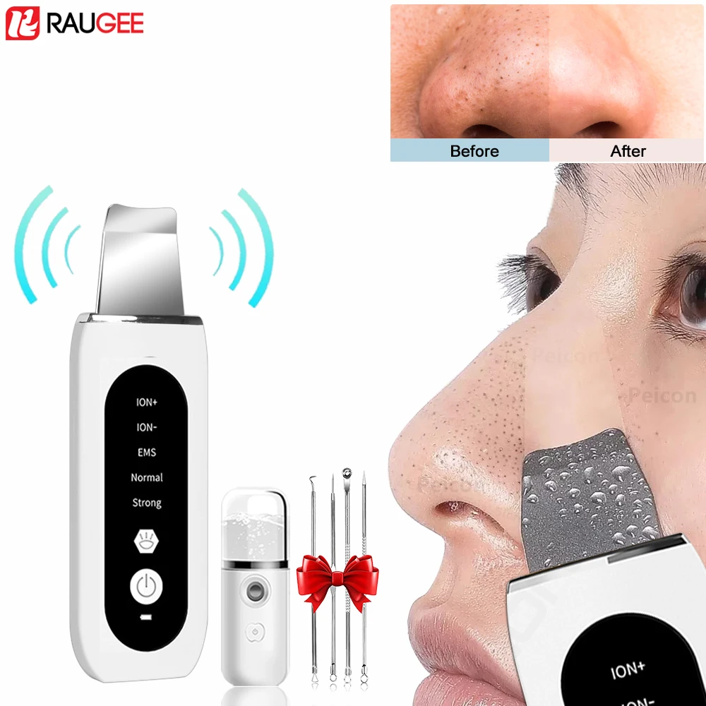 Ultrasonic Skin Scrubber Peeling Ion Acne Pore Cleaner Blackhead Remover Deep Face Cleaning Ultrasonic Facial Shovel Cleanser