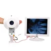 Medical X-ray fluoroscopic machine for radiology 1