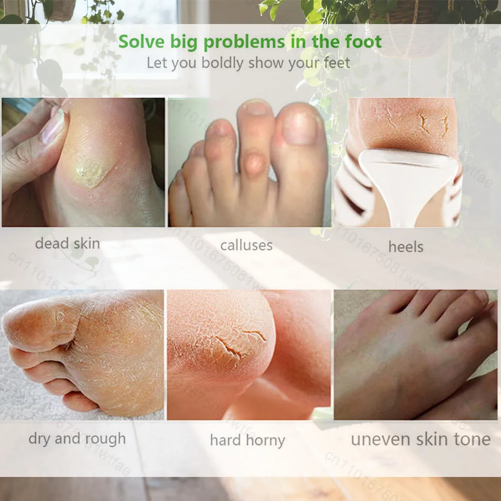 Exfoliating Foot Mask Foot SPA Pedicure Socks Exfoliation Scrub Remove Dead Skin Pedicure Socks Whitening Foot Foot Skin Care