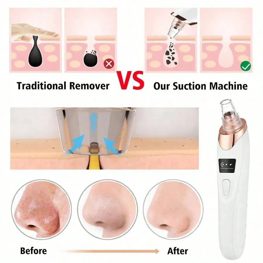 Electric Facial Skin Care Pore Removal Cleanser Vacuum Acne Removal For Deep Facial Pores 3