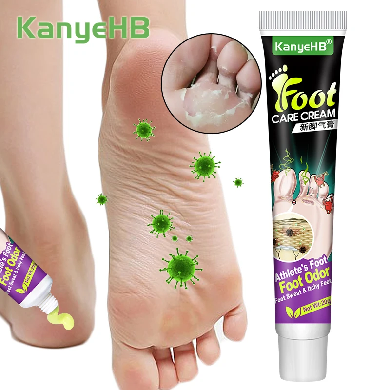 1 шт. Лікування грибка стопи Відновлюючий крем для догляду за ногами проти інфекції Бери-бери Видалення запаху стопи Полегшення свербіння шкіри ніг Мазь G027