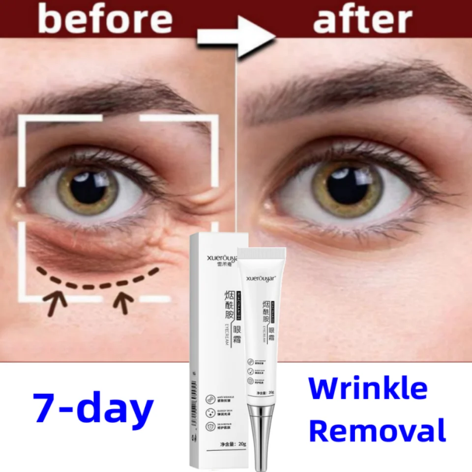 7 Days Lift Firm Anti-Wrinkle Eye Cream Remove Eye Bags Dark Circles Anti-Puffiness Fade Fine Lines Anti-aging Moisturize Whiten