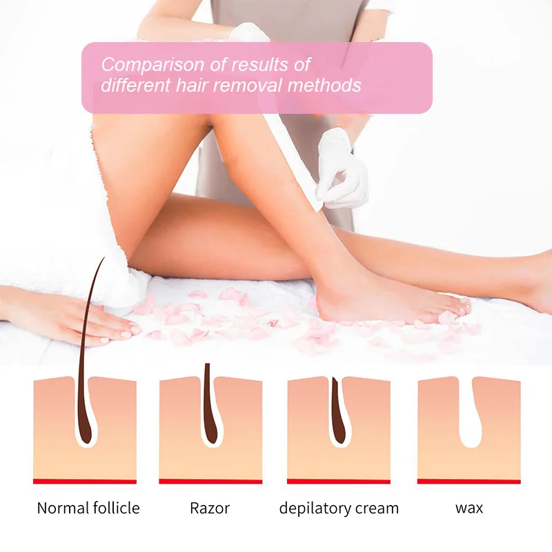 Portable Handheld Electric Heating Wax Machine Body Hair Removal Kerotherapy Hot Wax Roller Chest Arm Leg Hair Depilator Tool