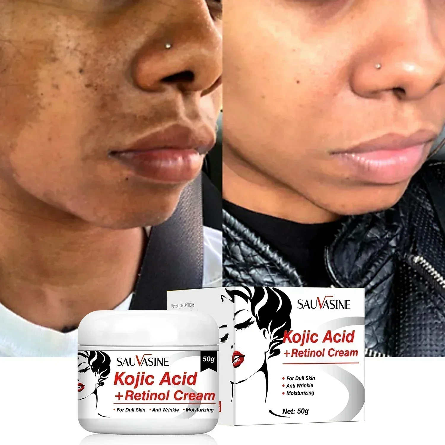 Kojic Acid Face Cream Retinol Whitening Cream Remove Dark Spots Anti Aging Brighten Moisturizing Nourishing Facial Skin Care ready stock correction brand freckle removal cream genuine product condensed skin transparent whitening spot official website