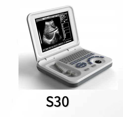 

Portable black and white ultrasound s30 with abdominal convex array probe