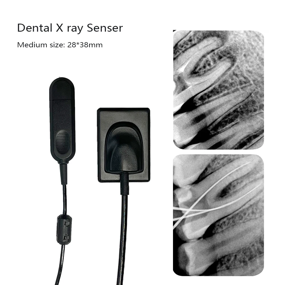 Dental X-Ray Digital Sensor Size 1 – APS CMOS, CsI Scintillator, 20lp/mm True Resolution