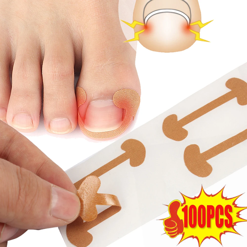 Nail Correction Stickers 100pcs Professional Painless Ingrown Toenail Correction Strips Waterproof Breathable Treatment Pedicure