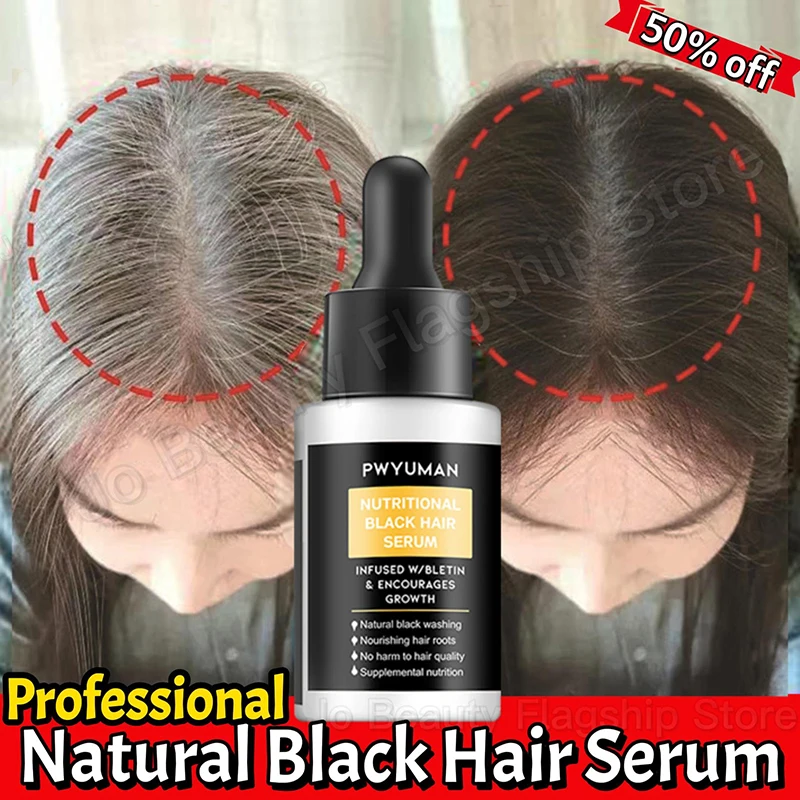 Esenciaparaelcabelloantigris,sueroennegrecidodelcabello,tratamientodelcabelloblanco,cuidadodereparacióndelcabelloblancoanegro,nutreelcuerocabelludo,antipérdidadecabello