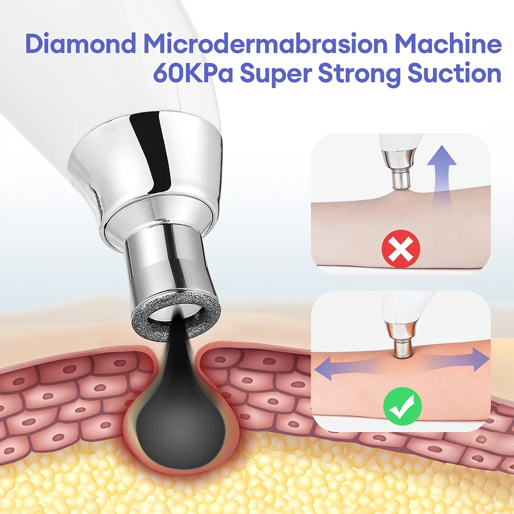 3 Tips Portable Diamond Microdermabrasion Facial Peeling Machine Diamond Exfoliation Deep Cleaning Vacuum Blackhead Remover