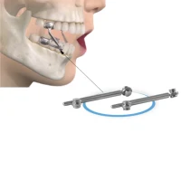 Appareil Herbst monté buccale fixe non amovible avec saut de morsure occlusal pour dispositif orthodontique de précision de Correction de classe II 1
