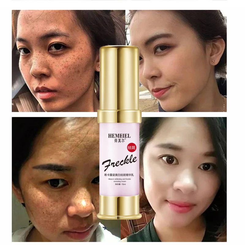 Hemeiel Strong Whitening Cream Dark Spot Corrector Face Bleaching Cream