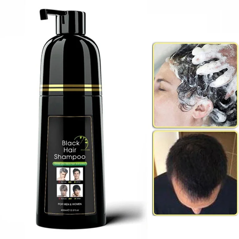 400ml 1pcs Plant Hair Dye Dyeing and Protecting One Covering White Hair Combing Black Men and Women Natural Black Dyeing Cream 2