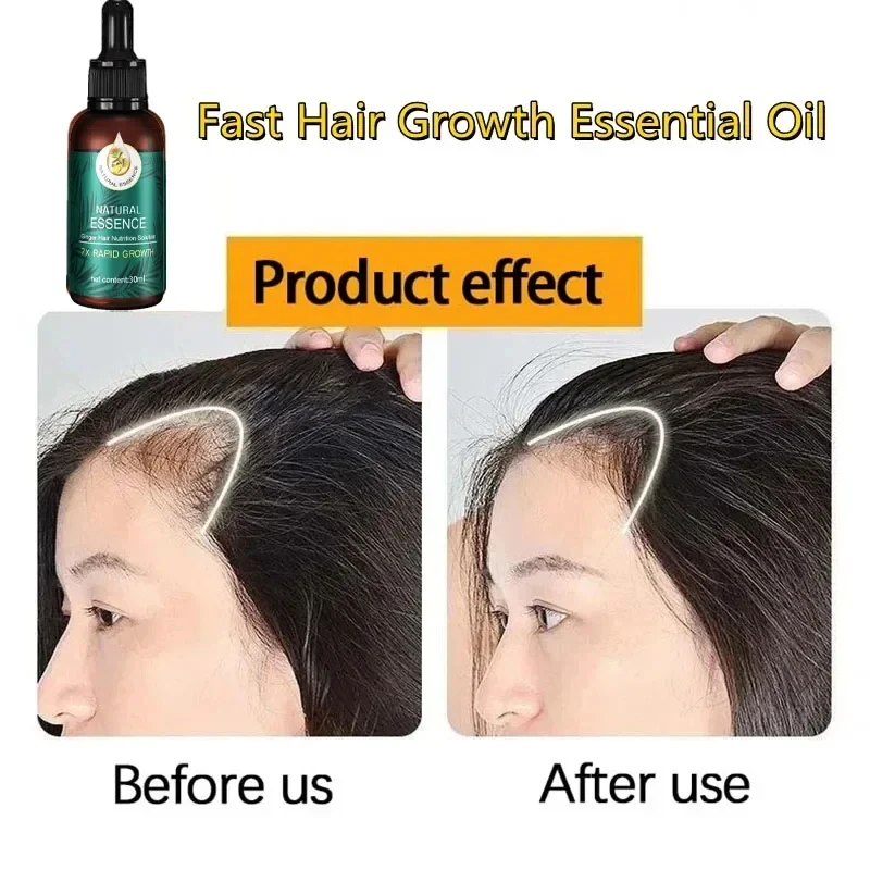 Natural Ginger Hair Care Essential Oil Hair Treatment Oil