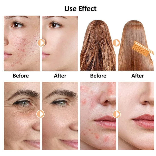 Electrotherapy Wand High Frequency Electrode Wand Neon Argon Electrode Glass Tube Wand Skin Tightening Remove Wrinkle Acne Spots