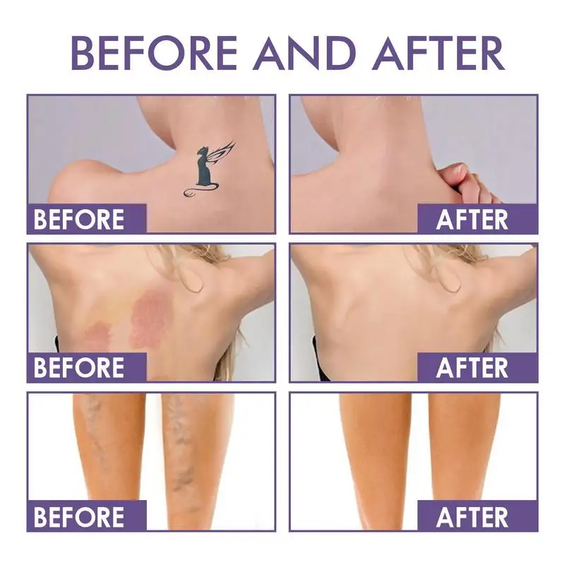Beauty Body Coverage Perfector Waterproof Skin Concealer Leg Body Moisturizer Colour Corrector For Veins Scars Uneven Skin Tone 5