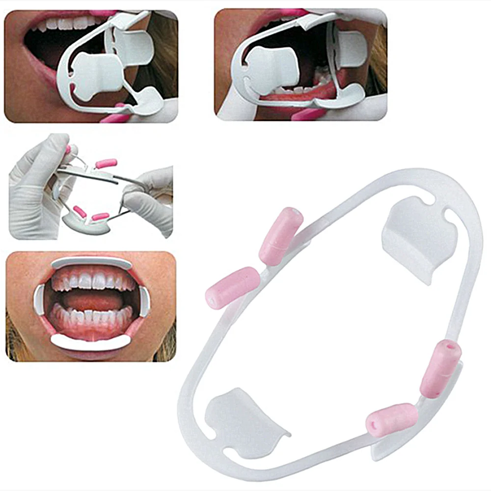 

1Pcs 3D Oral Dental Mouth Opener Lip Retractor Orthodontic Professional Dentist Tools Dentistry Materials Dental Instrument
