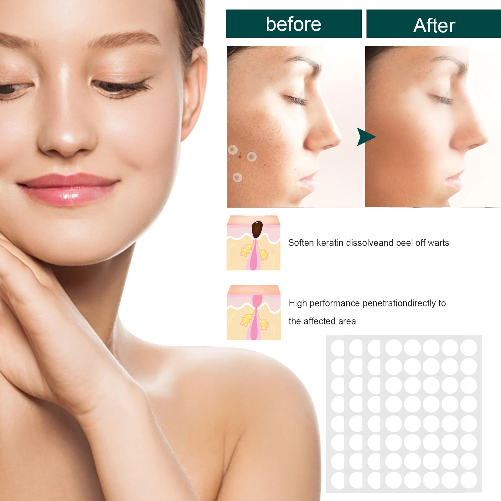 Description Picture 6 of itemPatch for Skin Cleansing Acne Treatmenthicken Eye Flesh Warts  Meats  Black Moles Skin Cleansing Sticker Covering for Men Women