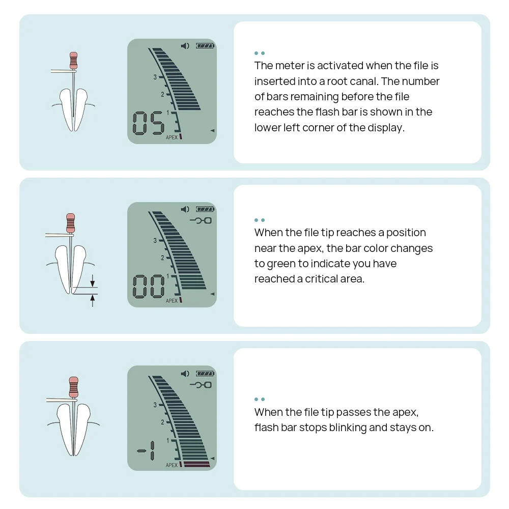 Рисунок 3 - Стоматологический эндонтический Апекслокатор