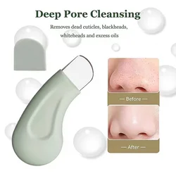 Ultimate Skin Pore Cleaner and Facial Care Tool (Green)