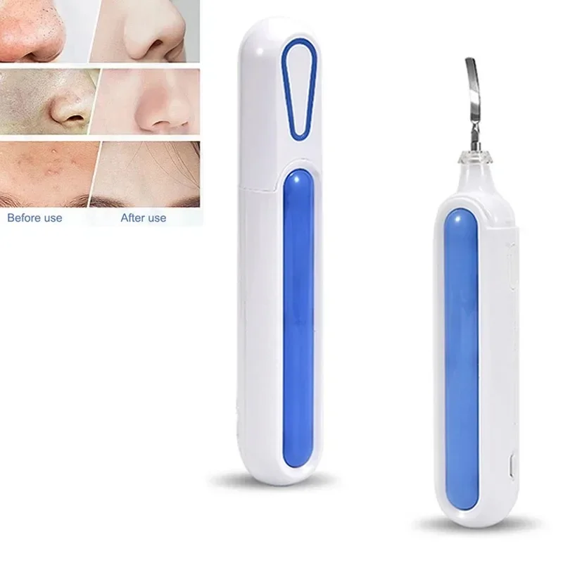 Ultrasonic Skin Scrubber Peeling Blackhead Remover Ultrasonic Ion Acne Pore Cleaner Facial Shovel Scrubber  Deep Face Cleaning